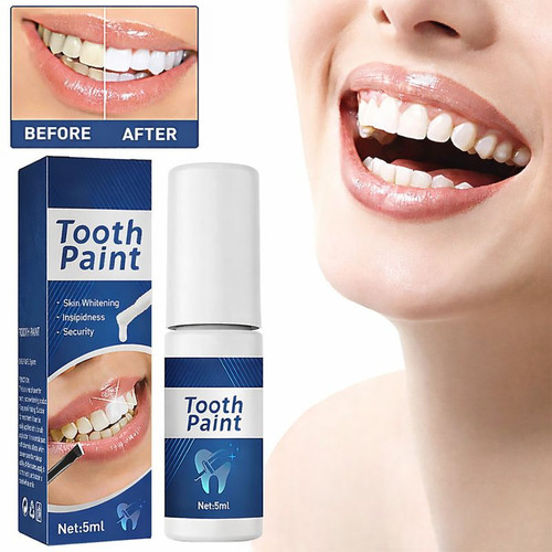 Teeth whitening gel tooth - teeth,