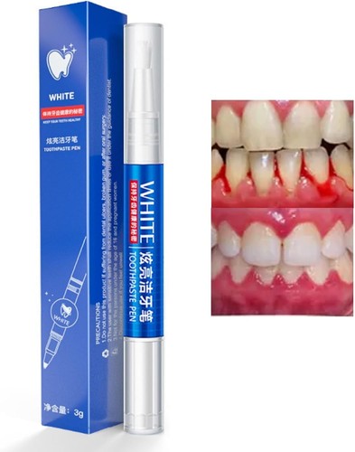 Teeth whitening pen instant - whitening, pen,