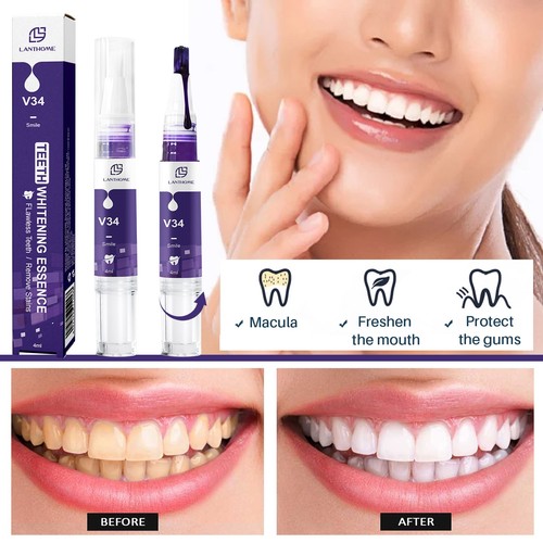 Advanced teeth whitening gel - whitening,
