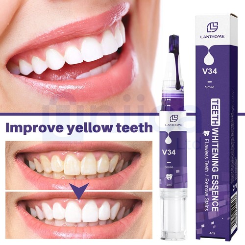 Advanced teeth whitening - advanced,